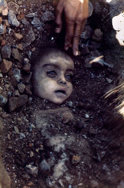 Mishra PK, Samarth RM, Pathak N, Jain S, Banerjee S, Maudar KK, Bhopal Gas Tragedy: Review of Clinical and Experimental Findings After 25 years, 2009: International Journal of Occupational Medicine and Environmental Health, Vol: 22, No: 3, p193-202.