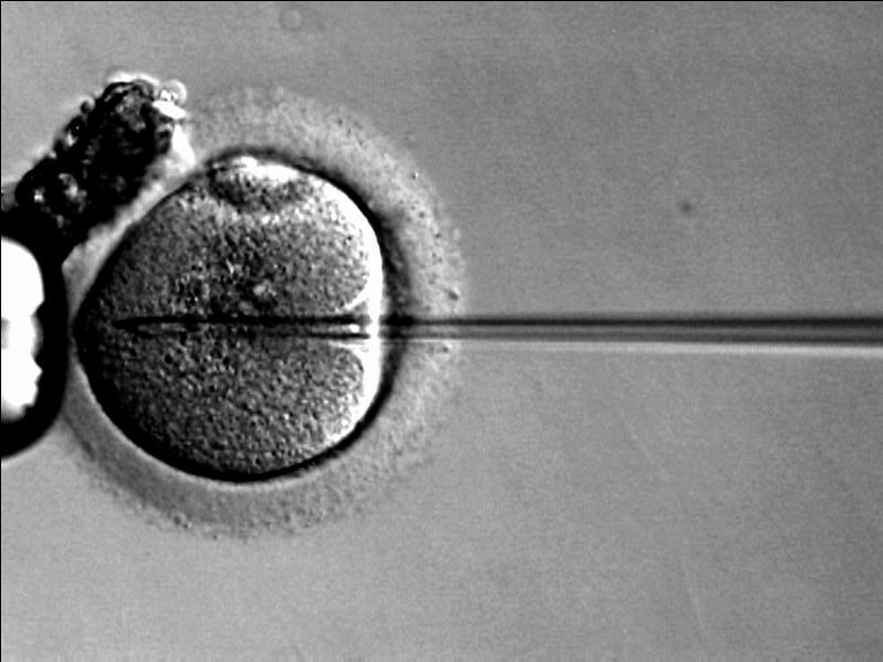 Inhorn MC, Middle Eastern Masculinities in the Age of New Reproductive Technologies: Male Infertility and Stigma in Egypt and Lebanon, 2004, Medical Anthropology Quarterly, Vol: 18, No: 2, p162-182.