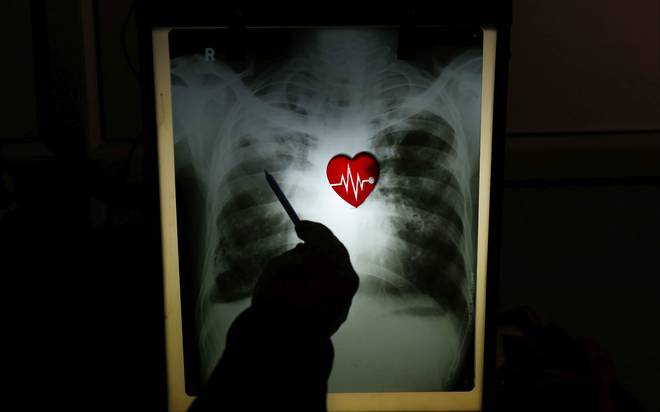G.M. Craig, A. Daftary, N. Engel, S. O’Driscoll, A. Ioannaki, Tuberculosis stigma as a social determinant of health: a systematic mapping review of research in low incidence countries, 2017, International Journal of Infectious Diseases, 56, 90-100.