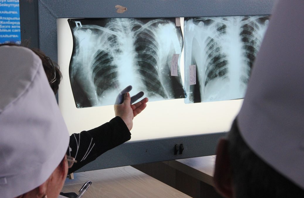 Yang W-T, Gounder CR, Akande T, et al, Barriers and Delays in Tuberculosis Diagnosis and Treatment Services: Does Gender Matter? , 2014, Tuberculosis Research and Treatment. 2014:461935, doi:10.1155/2014/461935.